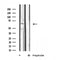 DF4742 staining  Hela cells by IF/ICC. The sample were fixed with PFA and permeabilized in 0.1% Triton X-100,then blocked in 10% serum for 45 minutes at 25¡ãC. The primary antibody was diluted at 1/200 and incubated with the sample for 1 hour at 37¡ãC. An  Alexa Fluor 594 conjugated goat anti-rabbit IgG (H+L) antibody(Cat.# S0006), diluted at 1/600, was used as secondary antibod