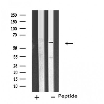 Western blot analysis of extracts from Hela cells, using CP26C antibody.