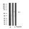 Western blot analysis of extracts from Hela cells, using CP26C antibody.