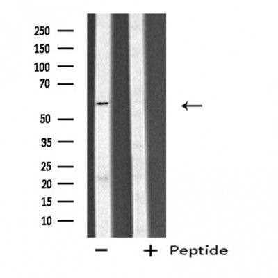 DF4744 at 1/100 staining Mouse liver tissue by IHC-P. The sample was formaldehyde fixed and a heat mediated antigen retrieval step in citrate buffer was performed. The sample was then blocked and incubated with the antibody for 1.5 hours at 22¡ãC. An HRP conjugated goat anti-rabbit antibody was used as the secondary