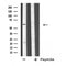 DF4744 at 1/100 staining Mouse liver tissue by IHC-P. The sample was formaldehyde fixed and a heat mediated antigen retrieval step in citrate buffer was performed. The sample was then blocked and incubated with the antibody for 1.5 hours at 22¡ãC. An HRP conjugated goat anti-rabbit antibody was used as the secondary