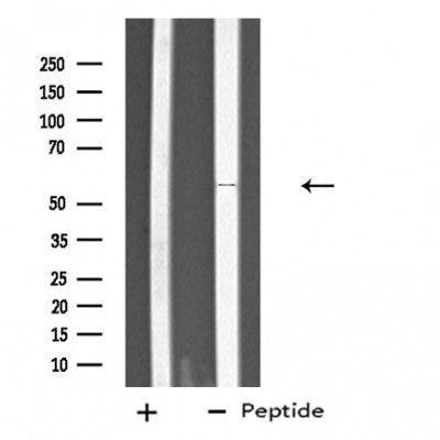 Western blot analysis of extracts from various samples, using PTGIS Antibody.
 Lane 1: Hela treated with blocking peptide;
 Lane 2: Hela;
Lane 3: 293.