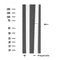 DF4746 staining Hela cells by IF/ICC. The sample were fixed with PFA and permeabilized in 0.1% Triton X-100,then blocked in 10% serum for 45 minutes at 25¡ãC. The primary antibody was diluted at 1/200 and incubated with the sample for 1 hour at 37¡ãC. An  Alexa Fluor 594 conjugated goat anti-rabbit IgG (H+L) antibody(Cat.# S0006), diluted at 1/600, was used as secondary antibod