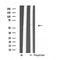 DF4747 at 1/100 staining Human uterus tissue by IHC-P. The sample was formaldehyde fixed and a heat mediated antigen retrieval step in citrate buffer was performed. The sample was then blocked and incubated with the antibody for 1.5 hours at 22¡ãC. An HRP conjugated goat anti-rabbit antibody was used as the secondary