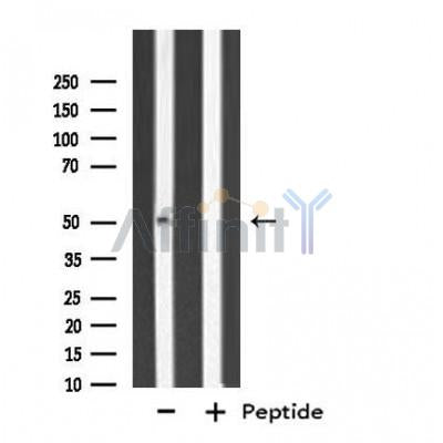 Western blot analysis of extracts from LOVO cells, using Cytochrome P450 3A7 antibody.