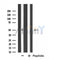 Western blot analysis of extracts from LOVO cells, using Cytochrome P450 3A7 antibody.