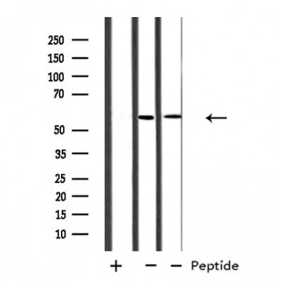 DF4753 at 1/100 staining Human lung cancer tissue by IHC-P. The sample was formaldehyde fixed and a heat mediated antigen retrieval step in citrate buffer was performed. The sample was then blocked and incubated with the antibody for 1.5 hours at 22¡ãC. An HRP conjugated goat anti-rabbit antibody was used as the secondary