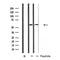 DF4753 at 1/100 staining Human lung cancer tissue by IHC-P. The sample was formaldehyde fixed and a heat mediated antigen retrieval step in citrate buffer was performed. The sample was then blocked and incubated with the antibody for 1.5 hours at 22¡ãC. An HRP conjugated goat anti-rabbit antibody was used as the secondary