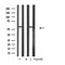 DF4754 staining Hela by IF/ICC. The sample were fixed with PFA and permeabilized in 0.1% Triton X-100,then blocked in 10% serum for 45 minutes at 25¡ãC. The primary antibody was diluted at 1/200 and incubated with the sample for 1 hour at 37¡ãC. An  Alexa Fluor 594 conjugated goat anti-rabbit IgG (H+L) Ab, diluted at 1/600, was used as the secondary antibod