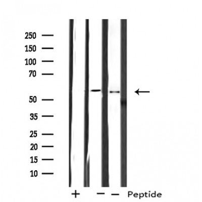 DF4755 at 1/100 staining Mouse liver tissue by IHC-P. The sample was formaldehyde fixed and a heat mediated antigen retrieval step in citrate buffer was performed. The sample was then blocked and incubated with the antibody for 1.5 hours at 22¡ãC. An HRP conjugated goat anti-rabbit antibody was used as the secondary