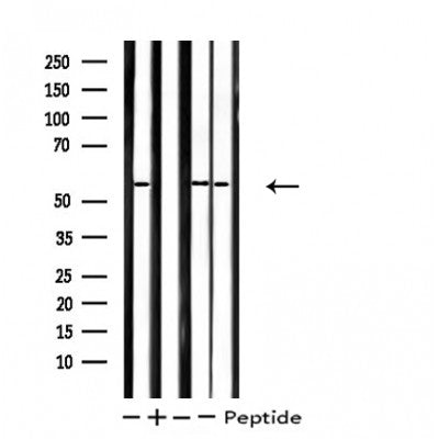 DF4756 staining  HT29 cells by IF/ICC. The sample were fixed with PFA and permeabilized in 0.1% Triton X-100,then blocked in 10% serum for 45 minutes at 25¡ãC. The primary antibody was diluted at 1/200 and incubated with the sample for 1 hour at 37¡ãC. An  Alexa Fluor 594 conjugated goat anti-rabbit IgG (H+L) antibody(Cat.# S0006), diluted at 1/600, was used as secondary antibod