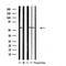 DF4756 staining  HT29 cells by IF/ICC. The sample were fixed with PFA and permeabilized in 0.1% Triton X-100,then blocked in 10% serum for 45 minutes at 25¡ãC. The primary antibody was diluted at 1/200 and incubated with the sample for 1 hour at 37¡ãC. An  Alexa Fluor 594 conjugated goat anti-rabbit IgG (H+L) antibody(Cat.# S0006), diluted at 1/600, was used as secondary antibod