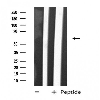 DF4758 staining  HT29 cells by IF/ICC. The sample were fixed with PFA and permeabilized in 0.1% Triton X-100,then blocked in 10% serum for 45 minutes at 25¡ãC. The primary antibody was diluted at 1/200 and incubated with the sample for 1 hour at 37¡ãC. An  Alexa Fluor 594 conjugated goat anti-rabbit IgG (H+L) antibody(Cat.# S0006), diluted at 1/600, was used as secondary antibod