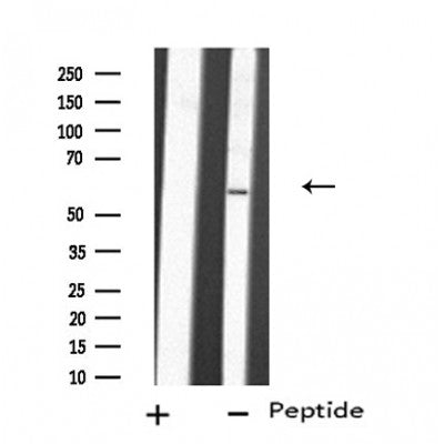 DF4759 staining HT29  cells by IF/ICC. The sample were fixed with PFA and permeabilized in 0.1% Triton X-100,then blocked in 10% serum for 45 minutes at 25¡ãC. The primary antibody was diluted at 1/200 and incubated with the sample for 1 hour at 37¡ãC. An  Alexa Fluor 594 conjugated goat anti-rabbit IgG (H+L) antibody(Cat.# S0006), diluted at 1/600, was used as secondary antibod