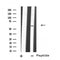 DF4759 staining HT29  cells by IF/ICC. The sample were fixed with PFA and permeabilized in 0.1% Triton X-100,then blocked in 10% serum for 45 minutes at 25¡ãC. The primary antibody was diluted at 1/200 and incubated with the sample for 1 hour at 37¡ãC. An  Alexa Fluor 594 conjugated goat anti-rabbit IgG (H+L) antibody(Cat.# S0006), diluted at 1/600, was used as secondary antibod