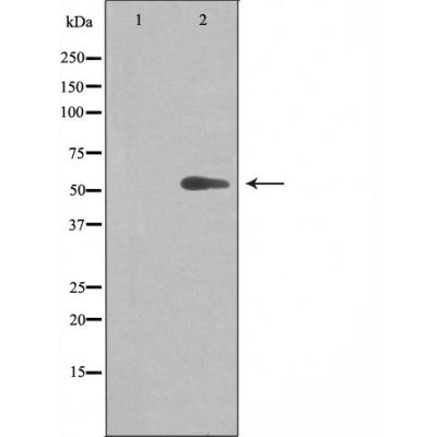 DF4760 staining Hela by IF/ICC. The sample were fixed with PFA and permeabilized in 0.1% Triton X-100,then blocked in 10% serum for 45 minutes at 25¡ãC. The primary antibody was diluted at 1/200 and incubated with the sample for 1 hour at 37¡ãC. An  Alexa Fluor 594 conjugated goat anti-rabbit IgG (H+L) Ab, diluted at 1/600, was used as the secondary antibod
