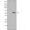 DF4760 staining Hela by IF/ICC. The sample were fixed with PFA and permeabilized in 0.1% Triton X-100,then blocked in 10% serum for 45 minutes at 25¡ãC. The primary antibody was diluted at 1/200 and incubated with the sample for 1 hour at 37¡ãC. An  Alexa Fluor 594 conjugated goat anti-rabbit IgG (H+L) Ab, diluted at 1/600, was used as the secondary antibod