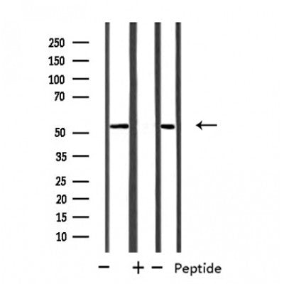 DF4761 at 1/100 staining Mouse liver tissue by IHC-P. The sample was formaldehyde fixed and a heat mediated antigen retrieval step in citrate buffer was performed. The sample was then blocked and incubated with the antibody for 1.5 hours at 22¡ãC. An HRP conjugated goat anti-rabbit antibody was used as the secondary