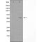 DF4762 at 1/100 staining Mouse liver tissue by IHC-P. The sample was formaldehyde fixed and a heat mediated antigen retrieval step in citrate buffer was performed. The sample was then blocked and incubated with the antibody for 1.5 hours at 22¡ãC. An HRP conjugated goat anti-rabbit antibody was used as the secondary
