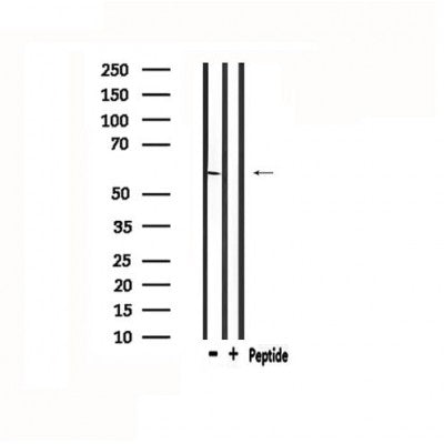 DF4768 at 1/100 staining Mouse brain tissue by IHC-P. The sample was formaldehyde fixed and a heat mediated antigen retrieval step in citrate buffer was performed. The sample was then blocked and incubated with the antibody for 1.5 hours at 22¡ãC. An HRP conjugated goat anti-rabbit antibody was used as the secondary
