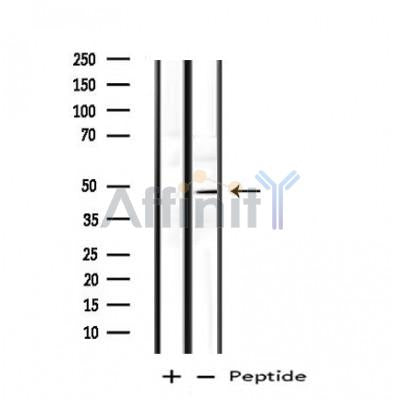 DF4769 at 1/100 staining Rat lung tissue by IHC-P. The sample was formaldehyde fixed and a heat mediated antigen retrieval step in citrate buffer was performed. The sample was then blocked and incubated with the antibody for 1.5 hours at 22¡ãC. An HRP conjugated goat anti-rabbit antibody was used as the secondary