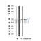 DF4769 at 1/100 staining Rat lung tissue by IHC-P. The sample was formaldehyde fixed and a heat mediated antigen retrieval step in citrate buffer was performed. The sample was then blocked and incubated with the antibody for 1.5 hours at 22¡ãC. An HRP conjugated goat anti-rabbit antibody was used as the secondary