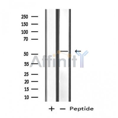 Western blot analysis of extracts from Hela, using MATK Antibody.