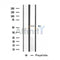 Western blot analysis of extracts from Hela, using MATK Antibody.