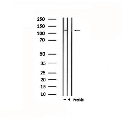 DF4776 staining HepG2 by IF/ICC. The sample were fixed with PFA and permeabilized in 0.1% Triton X-100,then blocked in 10% serum for 45 minutes at 25¡ãC. The primary antibody was diluted at 1/200 and incubated with the sample for 1 hour at 37¡ãC. An  Alexa Fluor 594 conjugated goat anti-rabbit IgG (H+L) Ab, diluted at 1/600, was used as the secondary antibod