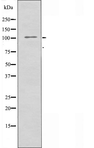 Western blot analysis of extracts from HepG2 cells using EPHA5 antibody.