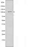 Western blot analysis of extracts from HepG2 cells using EPHA5 antibody.