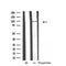 DF4784 staining  HepG2 cells by IF/ICC. The sample were fixed with PFA and permeabilized in 0.1% Triton X-100,then blocked in 10% serum for 45 minutes at 25¡ãC. The primary antibody was diluted at 1/200 and incubated with the sample for 1 hour at 37¡ãC. An  Alexa Fluor 594 conjugated goat anti-rabbit IgG (H+L) antibody(Cat.# S0006), diluted at 1/600, was used as secondary antibod