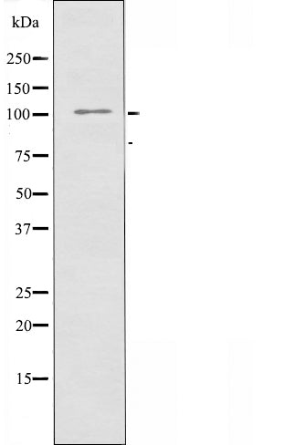 DF4785 staining Hela by IF/ICC. The sample were fixed with PFA and permeabilized in 0.1% Triton X-100,then blocked in 10% serum for 45 minutes at 25¡ãC. The primary antibody was diluted at 1/200 and incubated with the sample for 1 hour at 37¡ãC. An  Alexa Fluor 594 conjugated goat anti-rabbit IgG (H+L) Ab, diluted at 1/600, was used as the secondary antibod