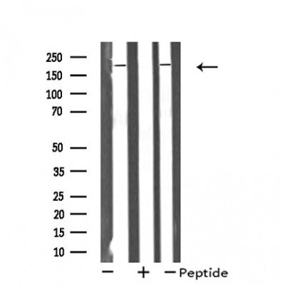Western blot analysis of extracts from Jurkat/COLO205 cells, using MRCKa antibody.