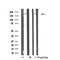 Western blot analysis of extracts from Jurkat/COLO205 cells, using MRCKa antibody.