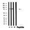 Western blot analysis of extracts from mouse brain, using PRKCG Antibody.