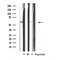 DF4791 at 1/100 staining Human heart tissue by IHC-P. The sample was formaldehyde fixed and a heat mediated antigen retrieval step in citrate buffer was performed. The sample was then blocked and incubated with the antibody for 1.5 hours at 22¡ãC. An HRP conjugated goat anti-rabbit antibody was used as the secondary