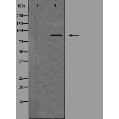 Western blot analysis of extracts from rat brain cells using TLK1 antibody.The lane on the left is treated with the antigen-specific peptide.