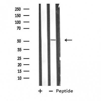 Western blot analysis of extracts from HeLa cells, using MNK2 antibody.