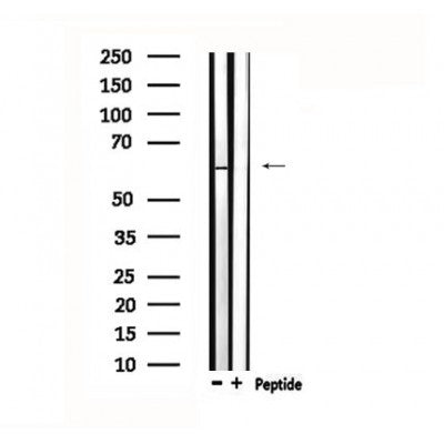 Western blot analysis of extracts from rat brain, using TESK2 Antibody.
