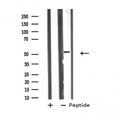 DF4796 staining HepG2 by IF/ICC. The sample were fixed with PFA and permeabilized in 0.1% Triton X-100,then blocked in 10% serum for 45 minutes at 25¡ãC. The primary antibody was diluted at 1/200 and incubated with the sample for 1 hour at 37¡ãC. An  Alexa Fluor 594 conjugated goat anti-rabbit IgG (H+L) Ab, diluted at 1/600, was used as the secondary antibod