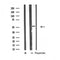 DF4796 staining HepG2 by IF/ICC. The sample were fixed with PFA and permeabilized in 0.1% Triton X-100,then blocked in 10% serum for 45 minutes at 25¡ãC. The primary antibody was diluted at 1/200 and incubated with the sample for 1 hour at 37¡ãC. An  Alexa Fluor 594 conjugated goat anti-rabbit IgG (H+L) Ab, diluted at 1/600, was used as the secondary antibod