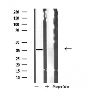 DF4797 staining K562 by IF/ICC. The sample were fixed with PFA and permeabilized in 0.1% Triton X-100,then blocked in 10% serum for 45 minutes at 25¡ãC. The primary antibody was diluted at 1/200 and incubated with the sample for 1 hour at 37¡ãC. An  Alexa Fluor 594 conjugated goat anti-rabbit IgG (H+L) Ab, diluted at 1/600, was used as the secondary antibod