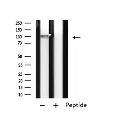DF4798 staining Hela cells by IF/ICC. The sample were fixed with PFA and permeabilized in 0.1% Triton X-100,then blocked in 10% serum for 45 minutes at 25¡ãC. The primary antibody was diluted at 1/200 and incubated with the sample for 1 hour at 37¡ãC. An  Alexa Fluor 594 conjugated goat anti-rabbit IgG (H+L) antibody(Cat.# S0006), diluted at 1/600, was used as secondary antibod