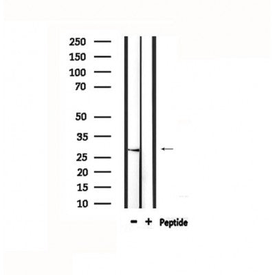 DF4804 staining HuvEc cells by IF/ICC. The sample were fixed with PFA and permeabilized in 0.1% Triton X-100,then blocked in 10% serum for 45 minutes at 25¡ãC. The primary antibody was diluted at 1/200 and incubated with the sample for 1 hour at 37¡ãC. An  Alexa Fluor 594 conjugated goat anti-rabbit IgG (H+L) antibody(Cat.# S0006), diluted at 1/600, was used as secondary antibod