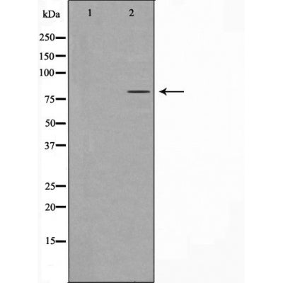 DF4809 at 1/100 staining Human breast cancer tissue by IHC-P. The sample was formaldehyde fixed and a heat mediated antigen retrieval step in citrate buffer was performed. The sample was then blocked and incubated with the antibody for 1.5 hours at 22¡ãC. An HRP conjugated goat anti-rabbit antibody was used as the secondary