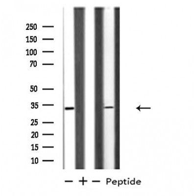 DF4812 staining Hela by IF/ICC. The sample were fixed with PFA and permeabilized in 0.1% Triton X-100,then blocked in 10% serum for 45 minutes at 25¡ãC. The primary antibody was diluted at 1/200 and incubated with the sample for 1 hour at 37¡ãC. An  Alexa Fluor 594 conjugated goat anti-rabbit IgG (H+L) Ab, diluted at 1/600, was used as the secondary antibod