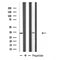 DF4812 staining Hela by IF/ICC. The sample were fixed with PFA and permeabilized in 0.1% Triton X-100,then blocked in 10% serum for 45 minutes at 25¡ãC. The primary antibody was diluted at 1/200 and incubated with the sample for 1 hour at 37¡ãC. An  Alexa Fluor 594 conjugated goat anti-rabbit IgG (H+L) Ab, diluted at 1/600, was used as the secondary antibod