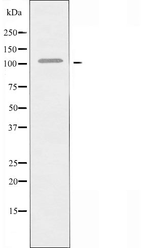 DF4815 staining Hela by IF/ICC. The sample were fixed with PFA and permeabilized in 0.1% Triton X-100,then blocked in 10% serum for 45 minutes at 25¡ãC. The primary antibody was diluted at 1/200 and incubated with the sample for 1 hour at 37¡ãC. An  Alexa Fluor 594 conjugated goat anti-rabbit IgG (H+L) Ab, diluted at 1/600, was used as the secondary antibod