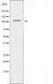 DF4815 staining Hela by IF/ICC. The sample were fixed with PFA and permeabilized in 0.1% Triton X-100,then blocked in 10% serum for 45 minutes at 25¡ãC. The primary antibody was diluted at 1/200 and incubated with the sample for 1 hour at 37¡ãC. An  Alexa Fluor 594 conjugated goat anti-rabbit IgG (H+L) Ab, diluted at 1/600, was used as the secondary antibod